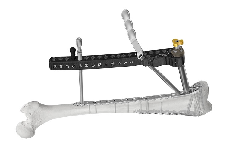 ANTHEM Distal Femur Fracture System
